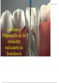 Limpieza y Preparación de los conductos radiculares en Endodoncia