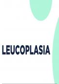 Presentación sobre la leucoplasia