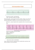 NR 340  EKG packet: RHYTHM AND CAUSES