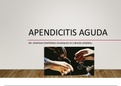 APENDICITIS AGUDA 