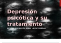 Depresión psicótica y su tratamiento