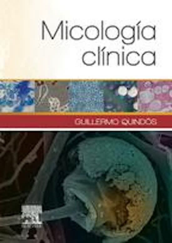 Micosis sitémicas